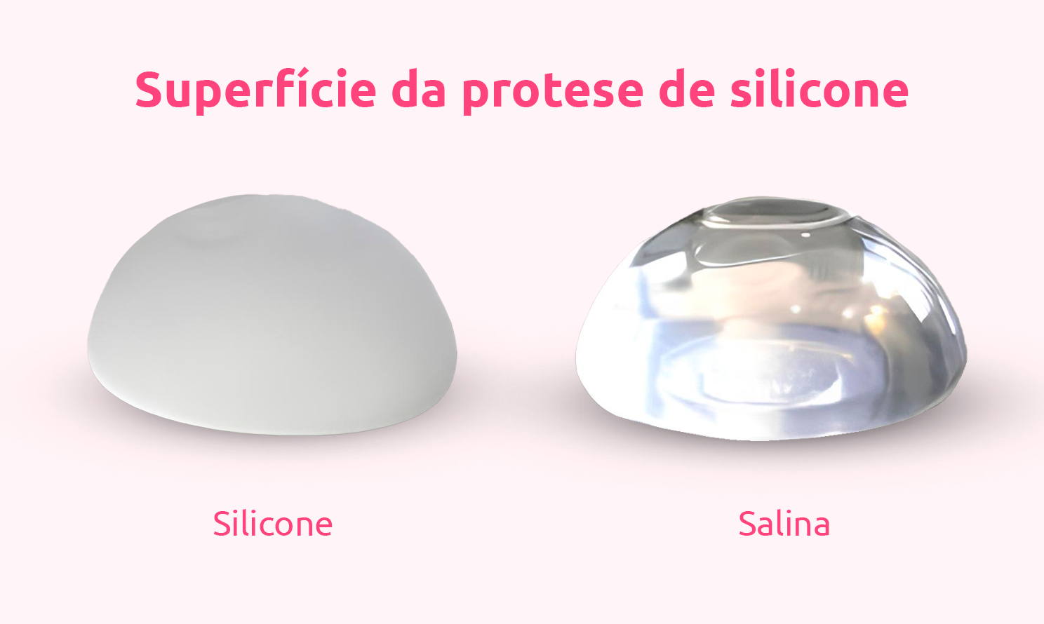 Tudo sobre Prótese de Silicone: Valores, Modelos e Mais 6 protese silicone salina