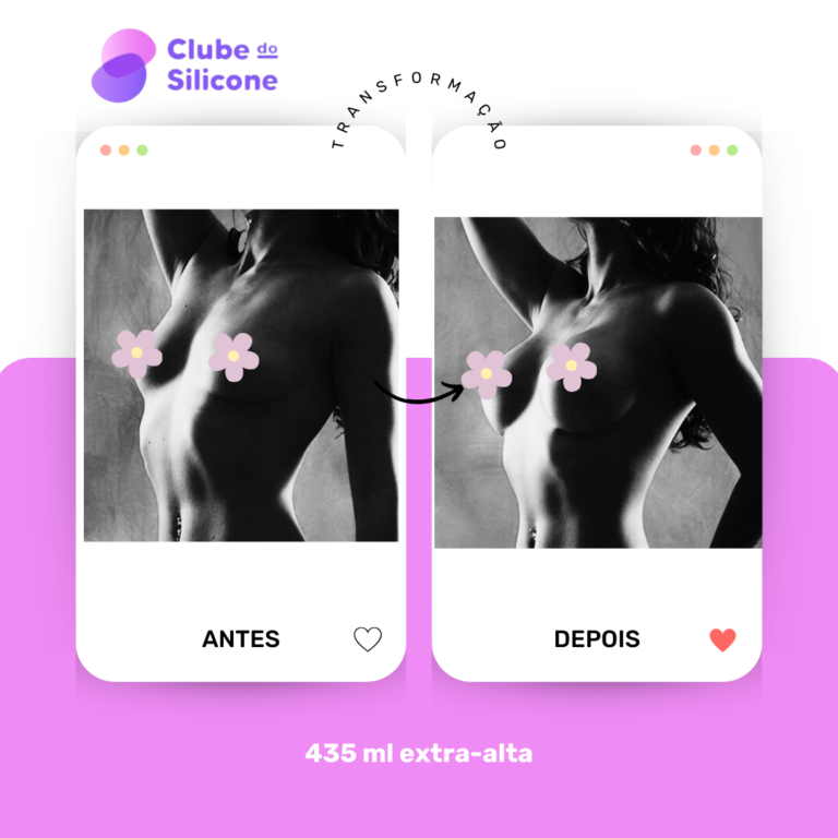Clube do Silicone