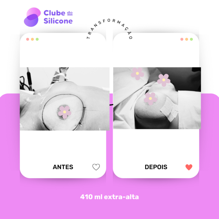 Clube do Silicone