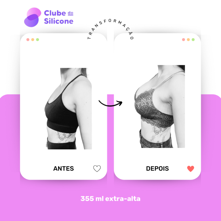 Clube do Silicone