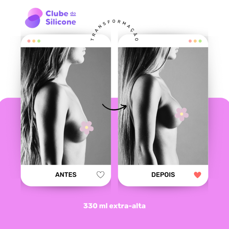 Clube do Silicone