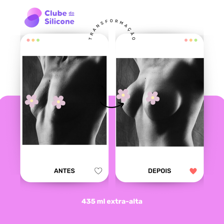 Clube do Silicone