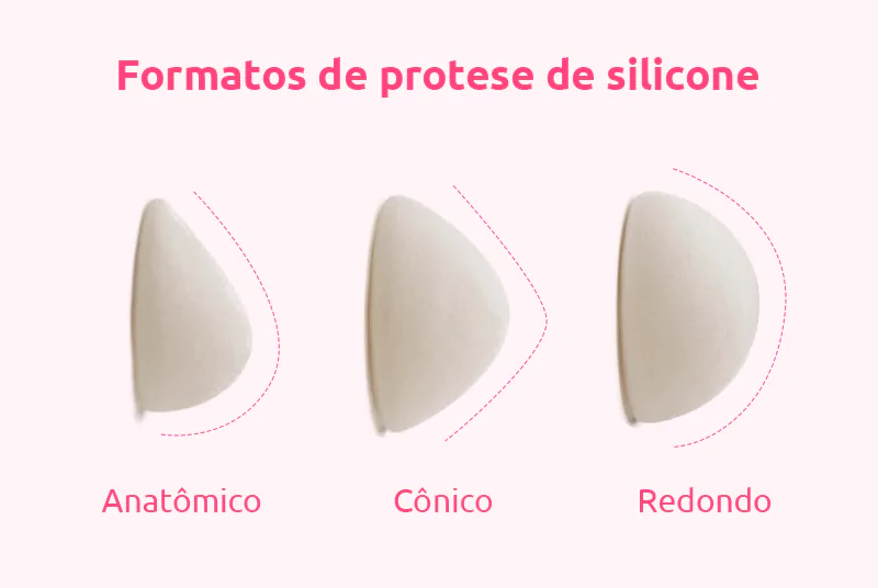 Tudo sobre Prótese de Silicone: Valores, Modelos e Mais 2 formatos de protese de silicone