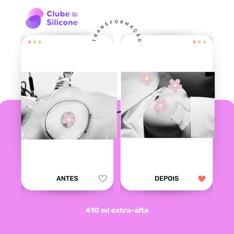 Clube do Silicone